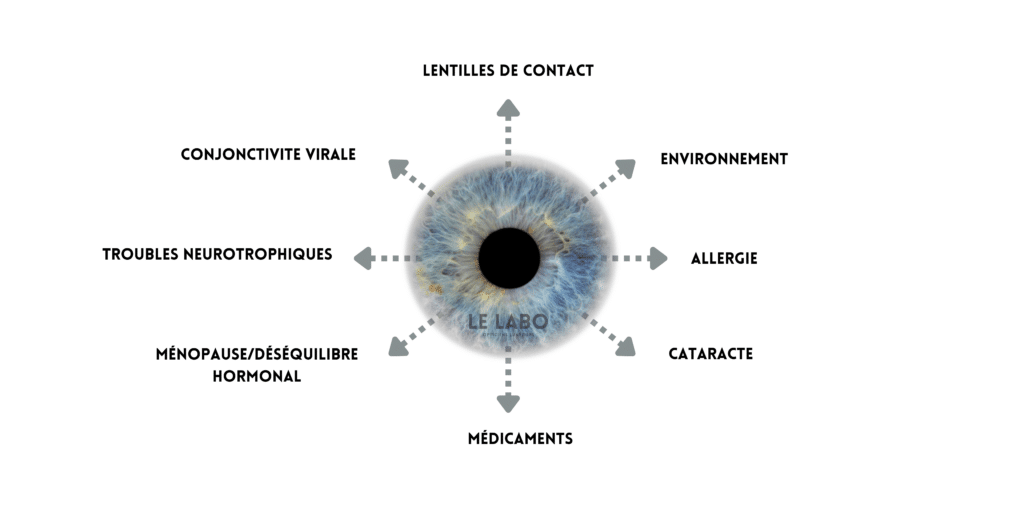 le labo opticiens lunetiers causes sécheresse oculaire